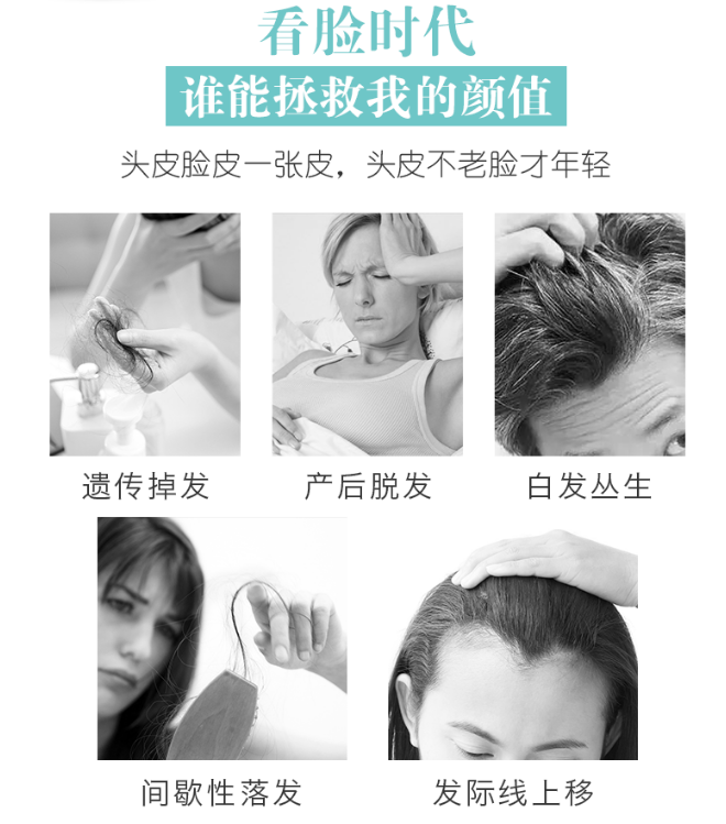 世界最新脱发治疗技术，步骤指南与突破方法
