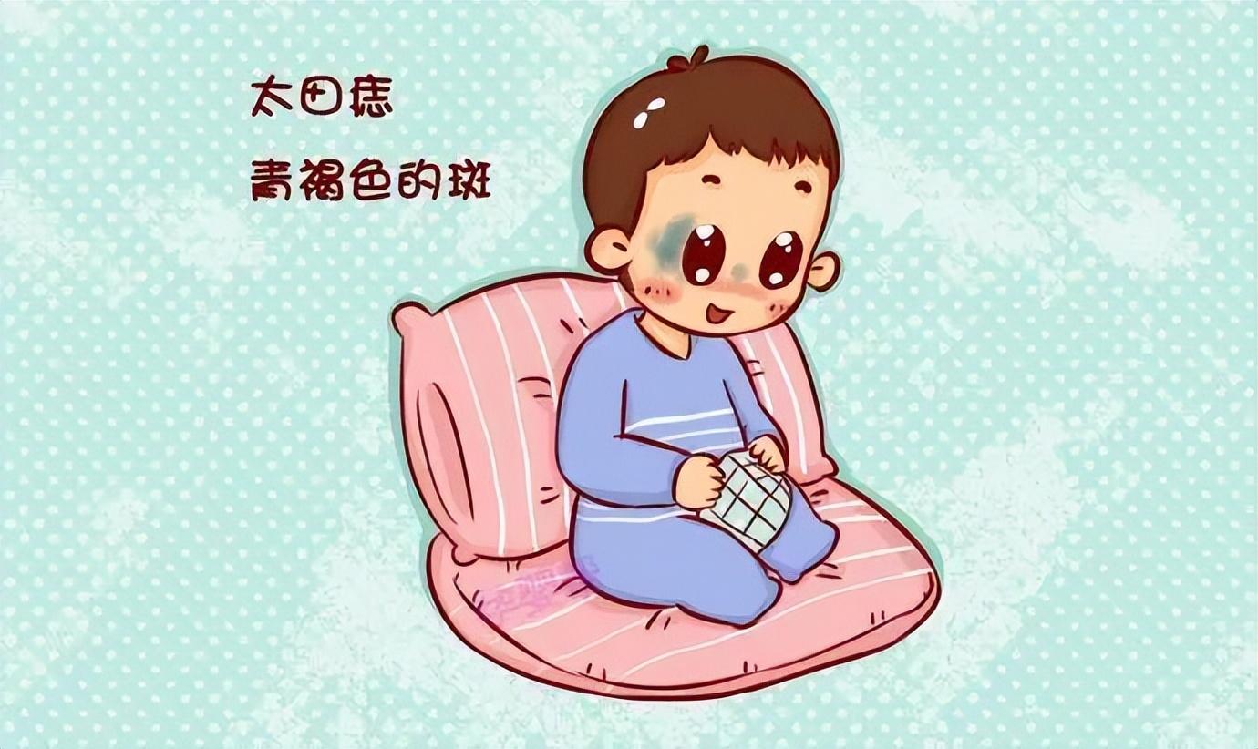 太田痣激光治疗价格表